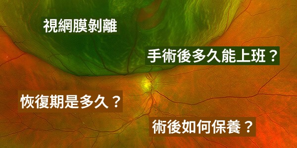 視網膜剝離手術後多久能上班？恢復期多久？術後如何保養？