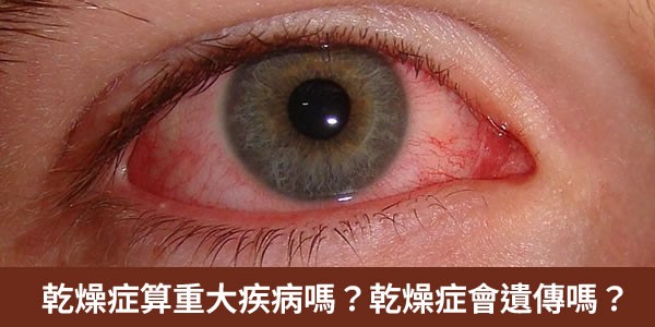 什麼是乾燥症？算重大疾病嗎？乾燥症會遺傳嗎？